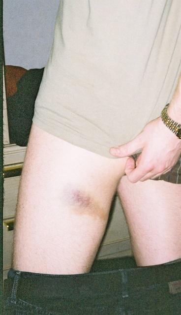 OUCHH thats gotta hurt